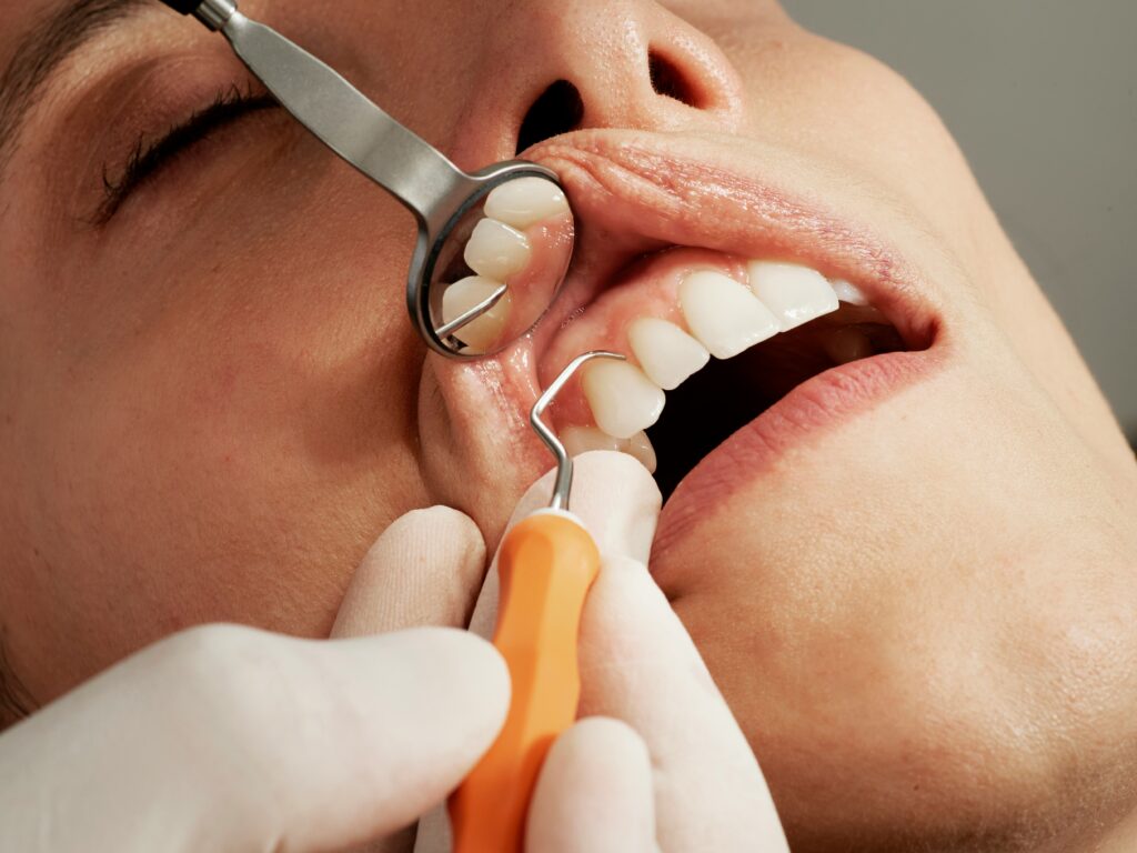 How long does numbness last after filling? A guide to dental anesthesia, lingering numbness, and recovery.