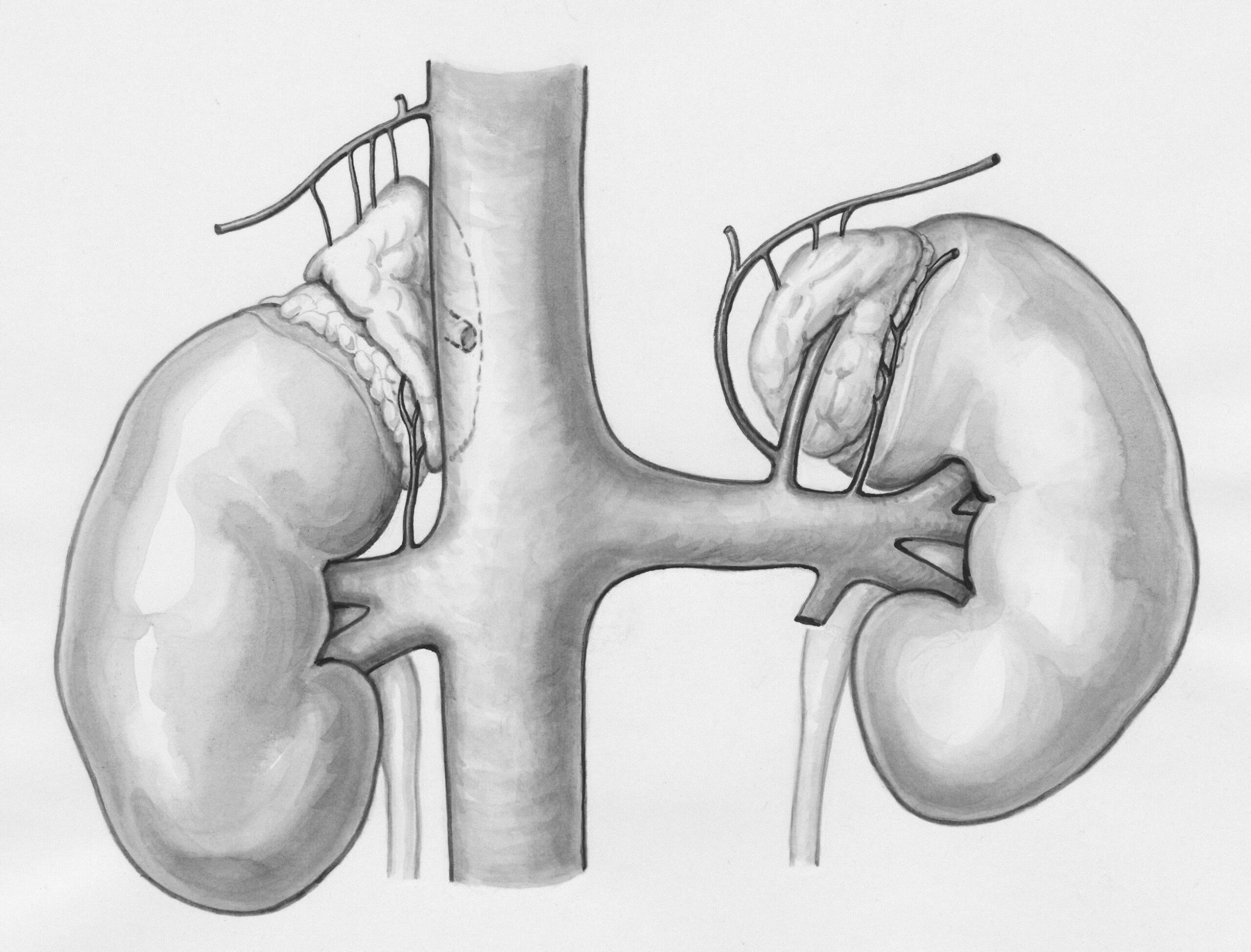 Uterine Ablation Side Effects Years Later: 9 Important Long-Term Changes to Know