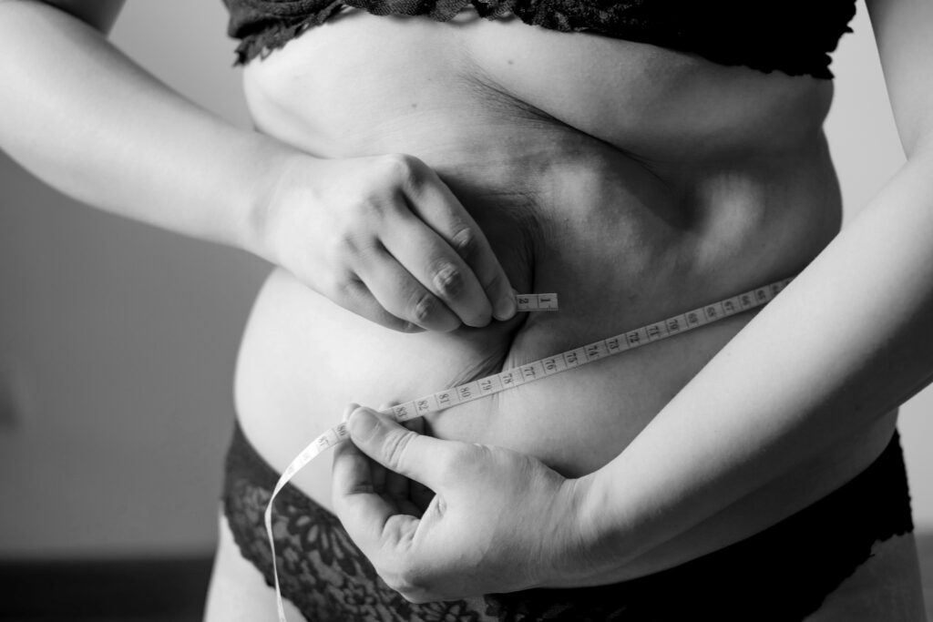 DIEP Flap Complications Years Later covering breast reconstruction concerns, fat necrosis, scar tissue, abdominal weakness, asymmetry, and long-term care.