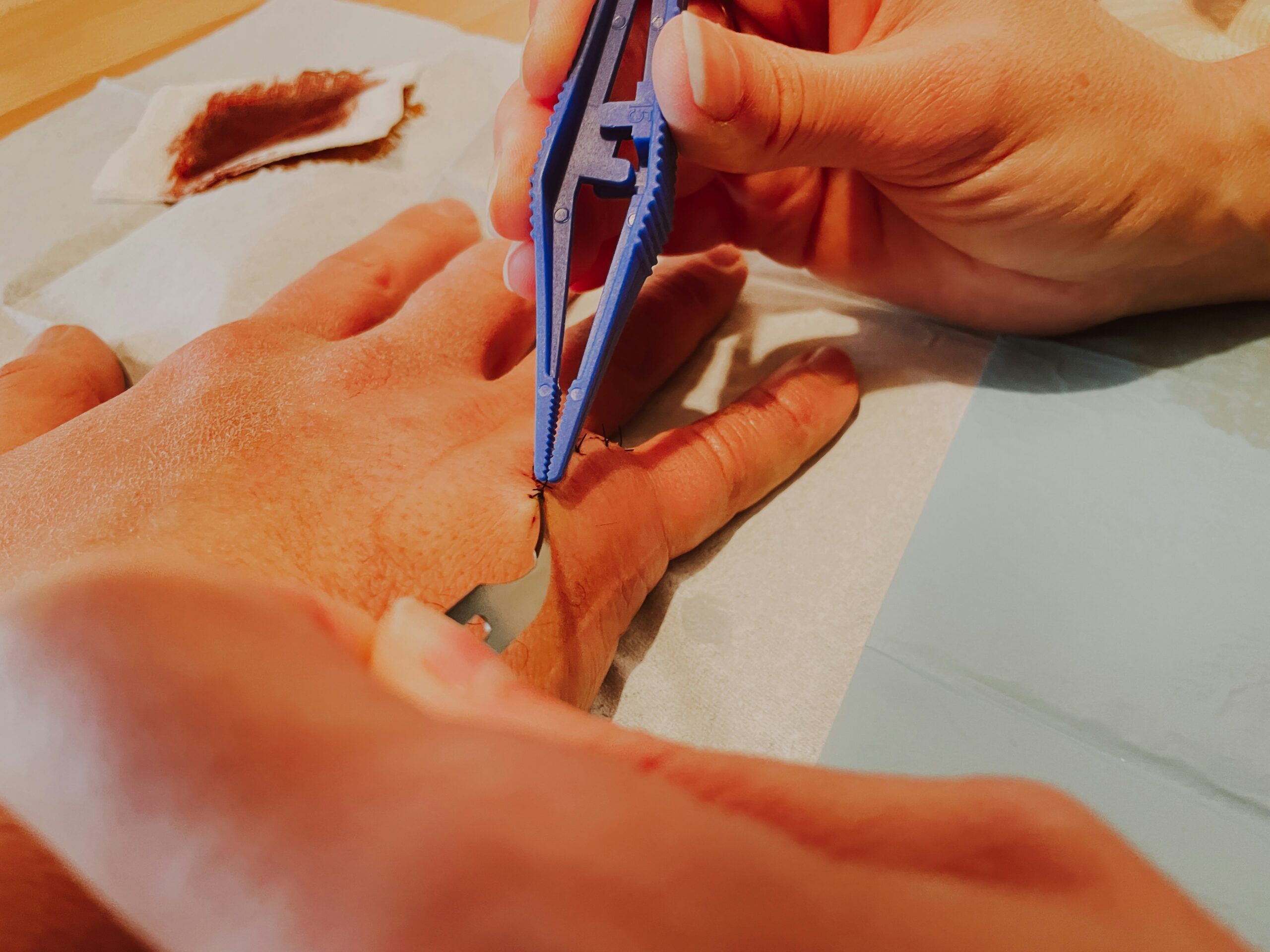 How to Get a Splinter Out Without Tweezers featuring safe splinter removal, tape, soaking, skin care, cleaning, and infection prevention.